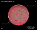 escherichia coli,salmonella,endo